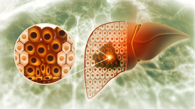 Deceased donor liver transplantation